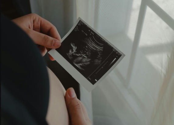 Is abortion legal in UK?